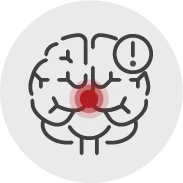 脑瘫专家刘秀芳医生善治病症:癫痫